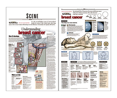 breast cancer graphic