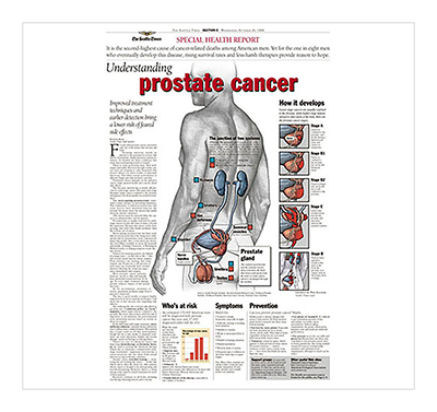 Prostate cancer graphic